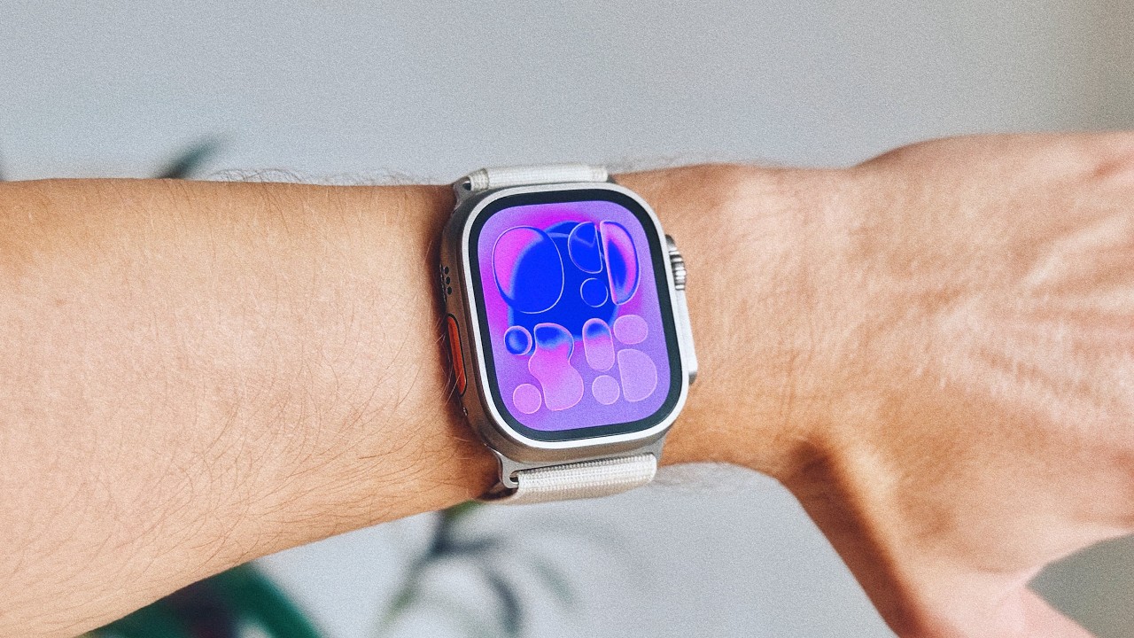 10 лет с Apple Watch: мощный инструмент для спорта и здоровья