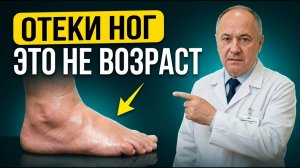 Отёки ног — проверьте эти 3 точки прямо сейчас. Если ямка останется — бегите к врачу!