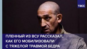 Пленный из ВСУ рассказал, как его мобилизовали с тяжелой травмой бедра