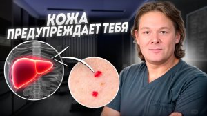 Красные точки на теле - это ОПАСНО! Как вылечить ангиомы НАВСЕГДА?