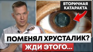 Это ждёт КАЖДОГО после замены хрусталика - вторичная катаракта