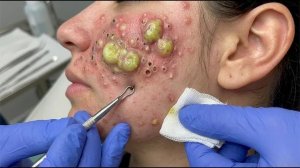 Нежный уход за порами и расслабление для гладкой кожи