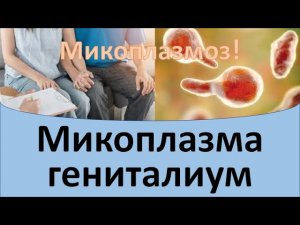 Микоплазма гениталиум