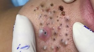Успокаивающий уход за лицом для снятия стресса в люкс-спа — обретите внутренний покой #