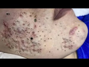 Обретите внутренний покой с этими методами очищения лица
