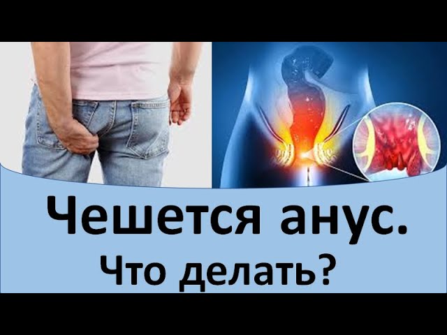 Задний Проход После Секса Задний Проход После Секса