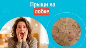 👉 Прыщи на лобке. Клинический случай № 1812