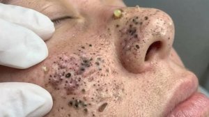 Нежный уход за порами и расслабление гладкой кожи