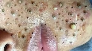 Нежный уход за порами и расслабление для гладкой кожи