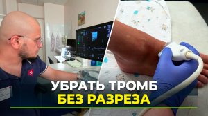 Ноябрьские врачи первыми на Ямале спасли пациента с тромбозом уколом в сосуд