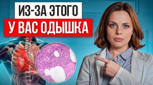 Сделайте ЭТО и одышка УЙДЕТ! / Как ЛЕГКО избавиться от одышки и что ее провоцирует?