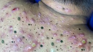 🧖 Нежное очищение лица и уход за кожей для глубокого расслабления