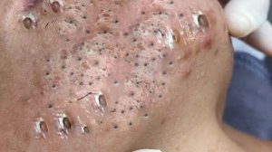 Нежный уход за порами и релакс для гладкой кожи