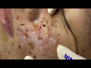 Обретите внутренний покой с помощью этих методов очищения лица