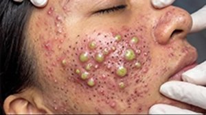 Нежный уход за порами и релаксация кожи