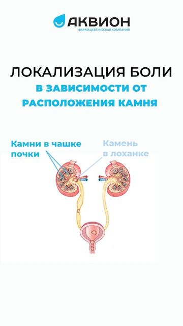 Мочекаменная болезнь: клиника✅