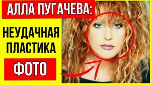 Что с ней? В Сети активно обсуждают новые снимки Аллы Пугачевой на Кипре