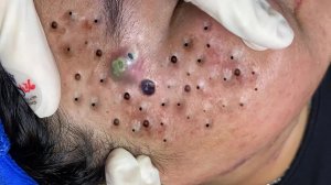 Достигните внутреннего покоя с помощью этих методов очищения лица