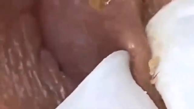крупные планы и детальная чистка лица смотреть онлайн