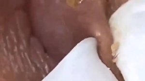 крупные планы и детальная чистка лица