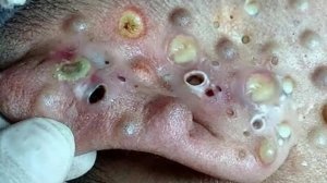 Нежный уход за порами и расслабление для гладкой кожи