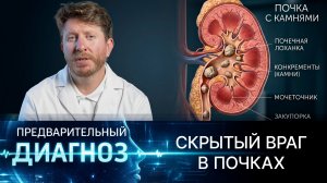 Камни уже внутри вас! Как уберечься от урологического заболевания?