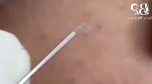 Успокаивающий уход за лицом для снятия стресса в спа-салоне