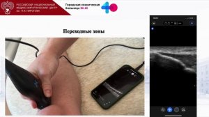 УЗИ Костно-Мыш системы начало Щепарев И.С.