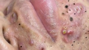 Нежный уход за порами и гладкая кожа 🧖♀️