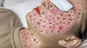 Расслабляющий уход за забитыми порами и гладкая кожа