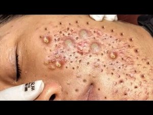 Расслабляющий уход за кожей: очищение для умиротворения
