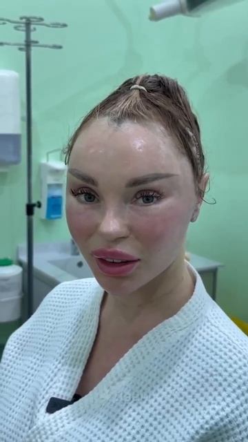В сети завирусилось видео, в котором пластический хирург продемонстрировал результат операции смотреть онлайн