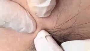 Успокаивающие моменты глубокой чистки лица #46326
