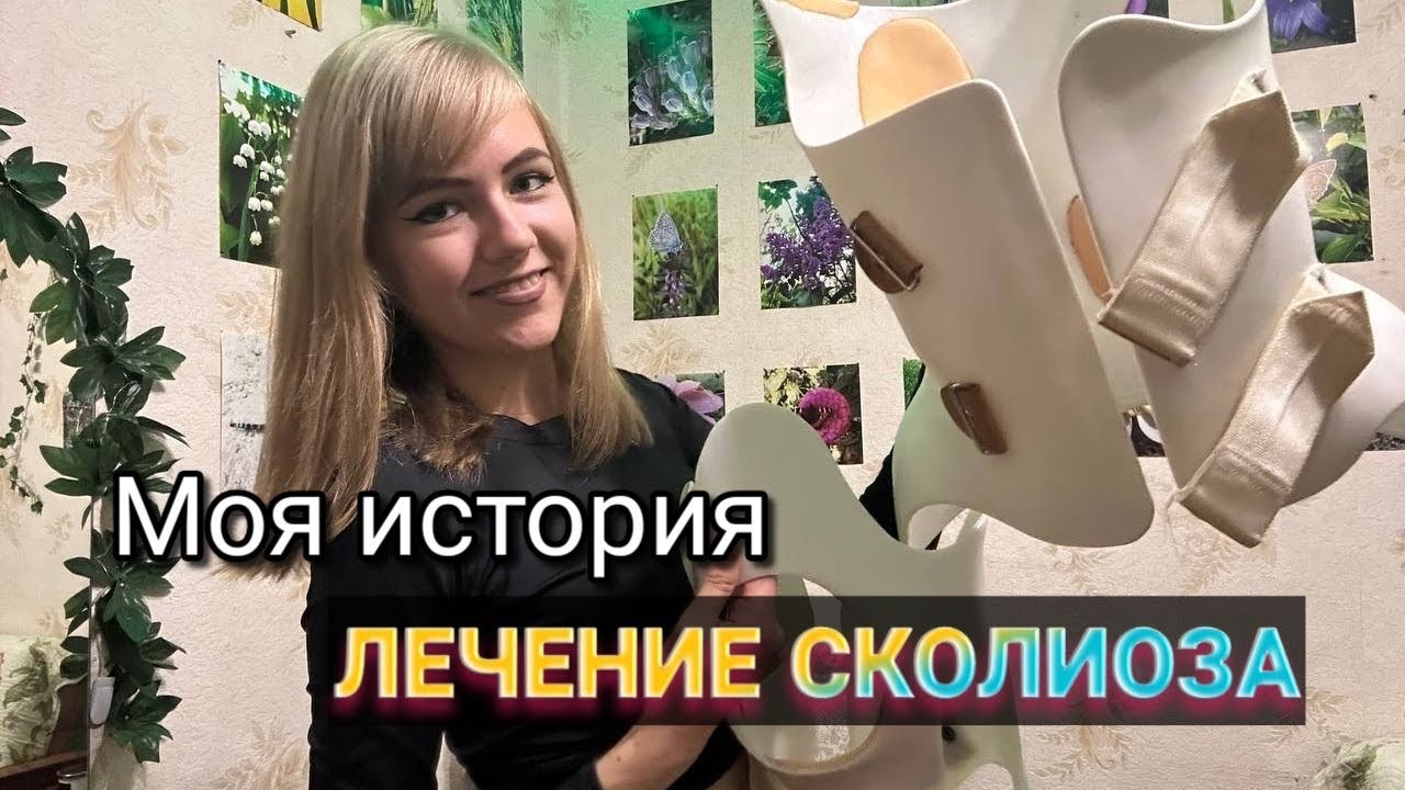 ИСТОРИЯ ЛЕЧЕНИЯ СКОЛИОЗА 2 СТЕПЕНИ #мотивация #корсет #отзывы смотреть онлайн