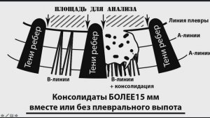 УЗИ легких  в акушерстве Щепарев И.С.