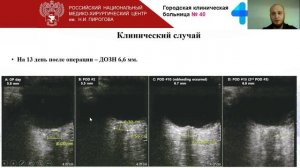 УЗИ Зрит Н часть 3 Щепарев И.С.