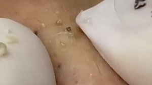 Советы по очищению и уходу за лицом 🧖♀️