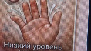 СИМПТОМЫ ЗАБОЛЕВАНИЙ 💥   ПОДПИШИСЬ💯