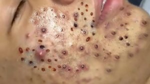 Успокаивающий уход за лицом для снятия стресса в спа-салоне