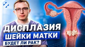 Дисплазия шейки матки: будет ли рак?