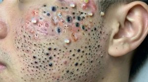 Успокаивающий уход за лицом для снятия стресса в спа-салоне
