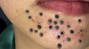 Расслабляющий уход за кожей: очищение