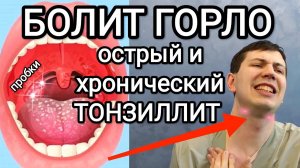 Как избавиться от гнойных пробок / Тонзиллит. Упражнения, полоскание, рекомендации