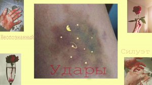 Неопознанный силуэт- удары