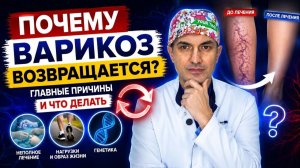Почему варикоз возвращается после операции? Флеболог Москва.