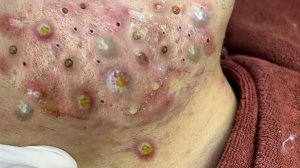 Поделитесь советами по очищению и уходу за лицом