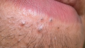 Глубокое очищение пор и удаление черных точек: корейский уход за кожей 🧖♀️✨