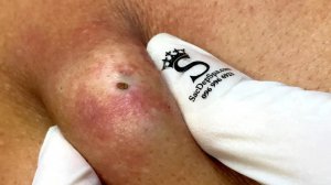 Успокаивающий уход за лицом для снятия стресса в люкс-спа