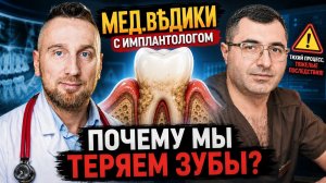 Почему люди теряют зубы, даже если чистят каждый день? Пародонтит, импланты и главные ошибки лечения