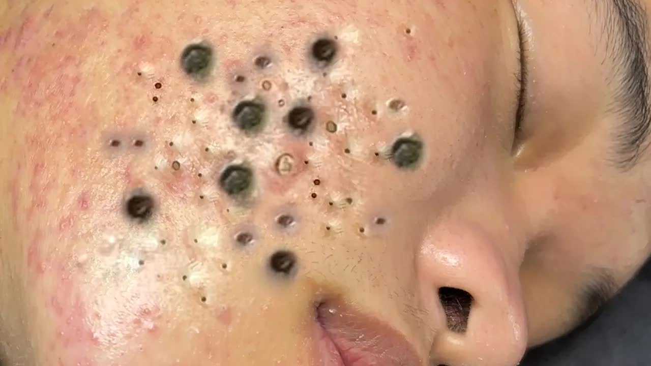 Расслабляющий уход за кожей: очищение 🧖 смотреть онлайн